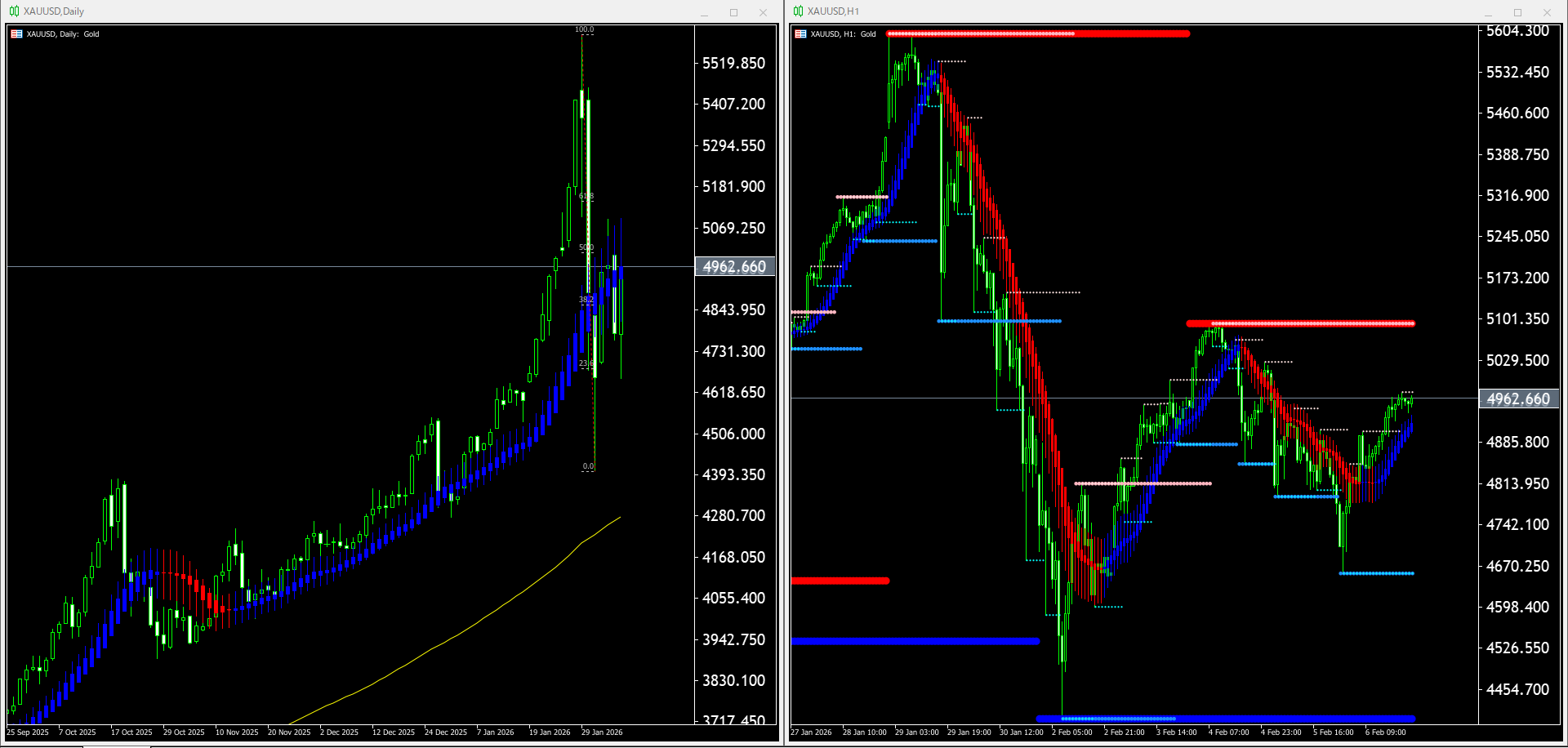 【金(XAU)】本日（2026年2月9日）のチャートテクニカル分析