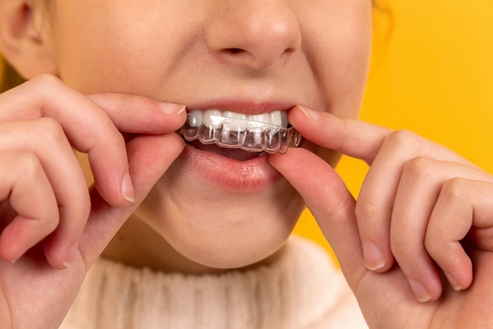 Clear Aligners: The Invisible Way to Straighten Your Teeth