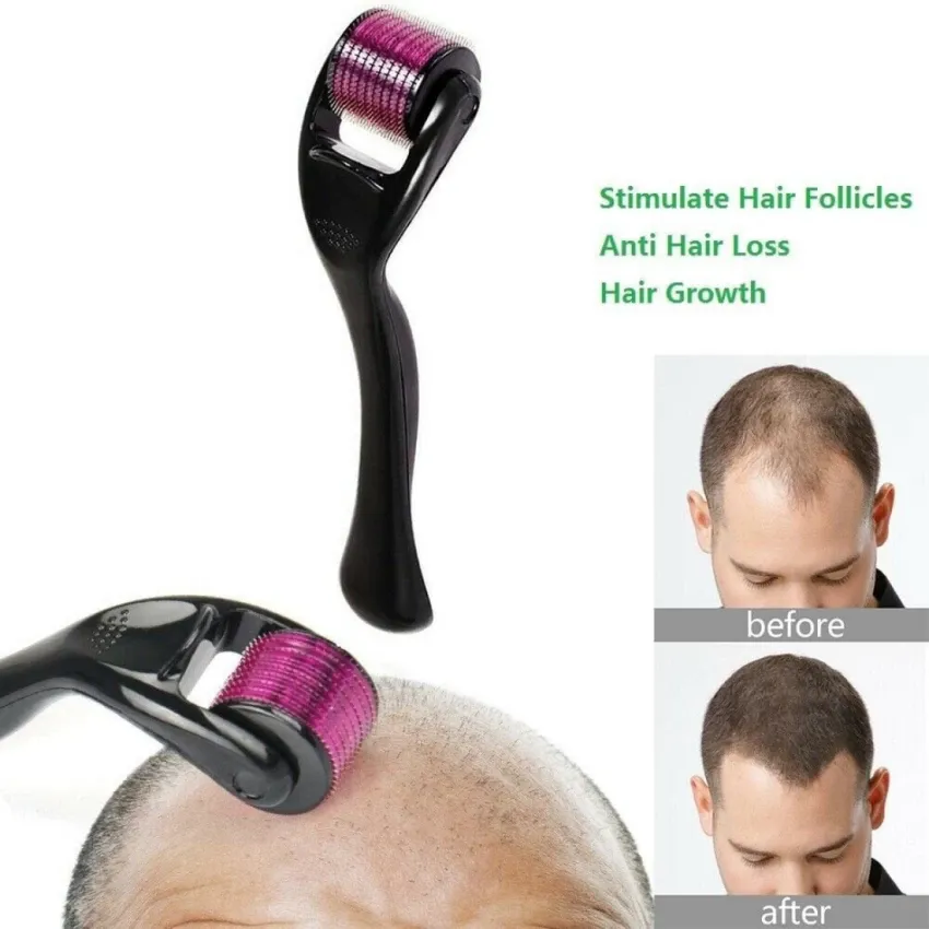 Derma Roller System For Face & Body 0.50mm 540 Needles Derma Roller 4