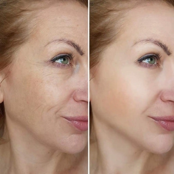 Osufi Collagen Face Serum (300ml) 6