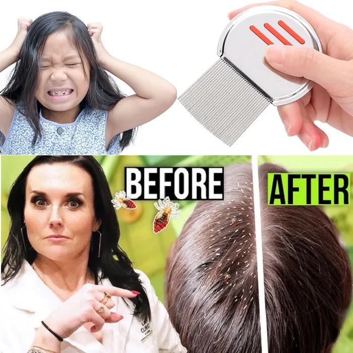 Stainless Steel Lice Removal Comb 7