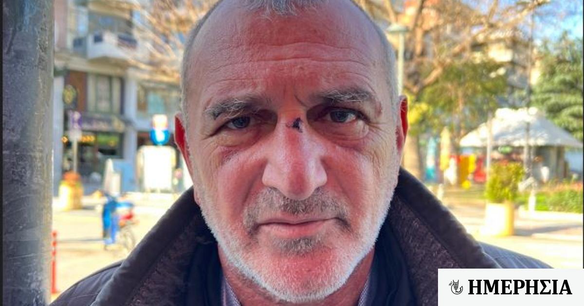 Τέμπη - Μαρτυρία: «Οταν άνοιξα τα μάτια τρελάθηκα... Οι επιβάτες στο 1ο βαγόνι είχαν εξαϋλωθεί» 1 tempi amp 8211 martyria otan anoixa ta matia trelathika amp 8230 oi epivates sto 1o vagoni eichan