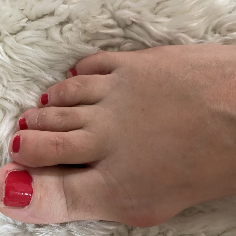Pieds très chaud – Image 2