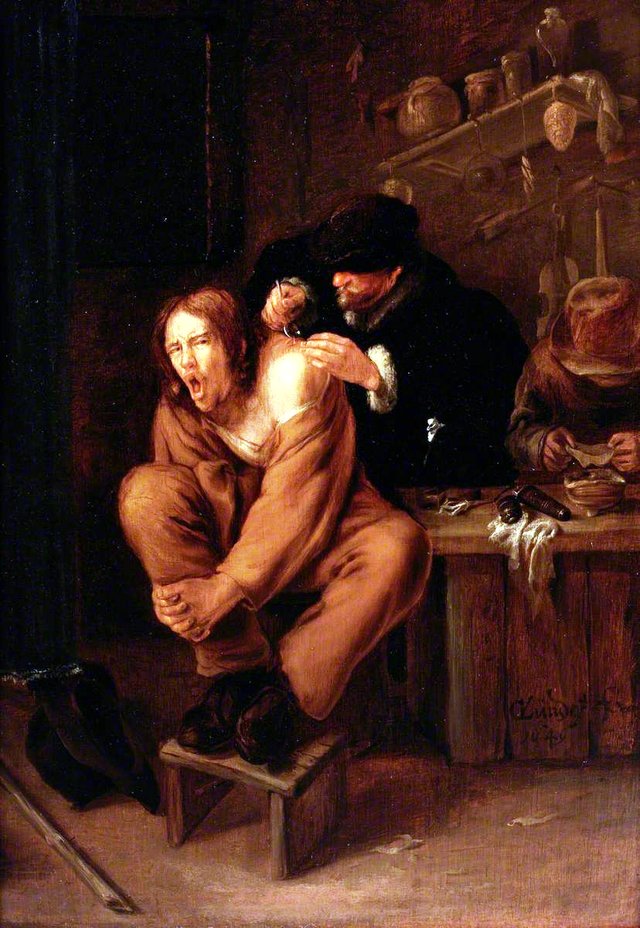 A Surgeon Applying Medicine to a Wound in the Shoulder of a Man in Pain by Gerrit Lundens
