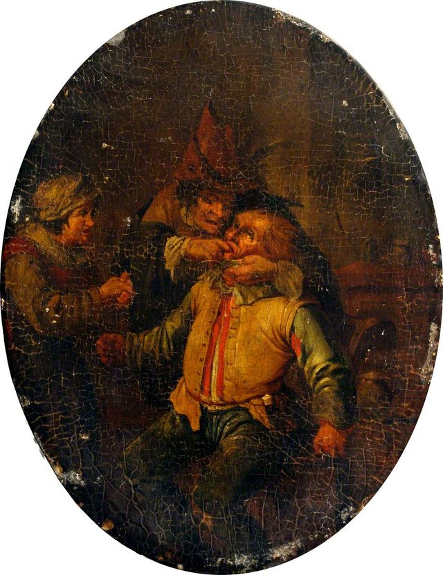 A Surgeon Extracting a Tooth by Andries Both