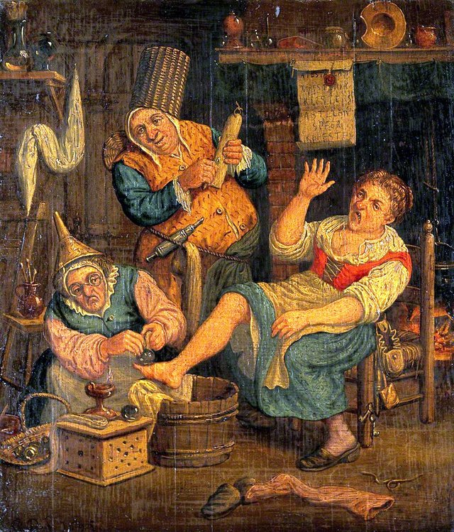 A Woman Surgeon and Her Assistant Cupping a Patient by Cornelis Dusart