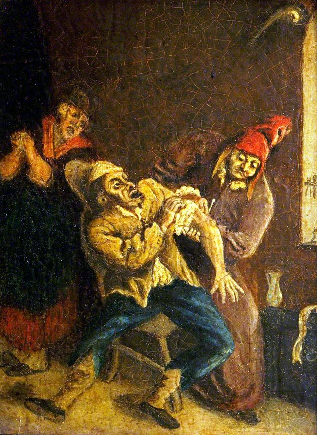 Surgeons Letting Blood by Cornelis Dusart