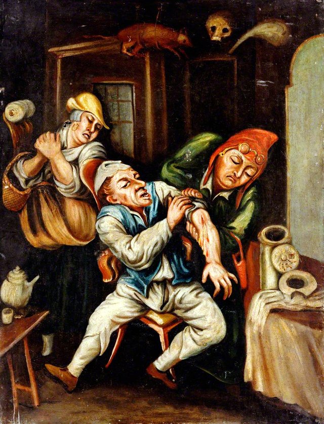 A Surgeon Attending to a Man's Arm by Cornelis Dusart