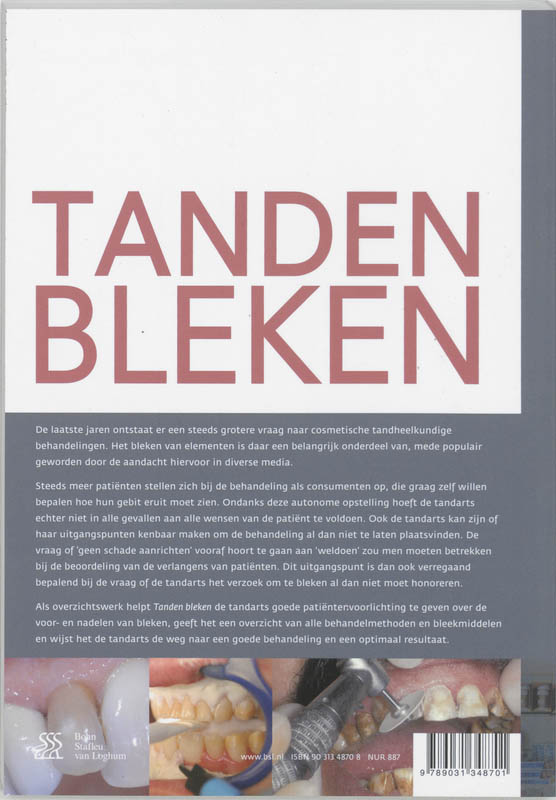 Achterkant van Tanden bleken