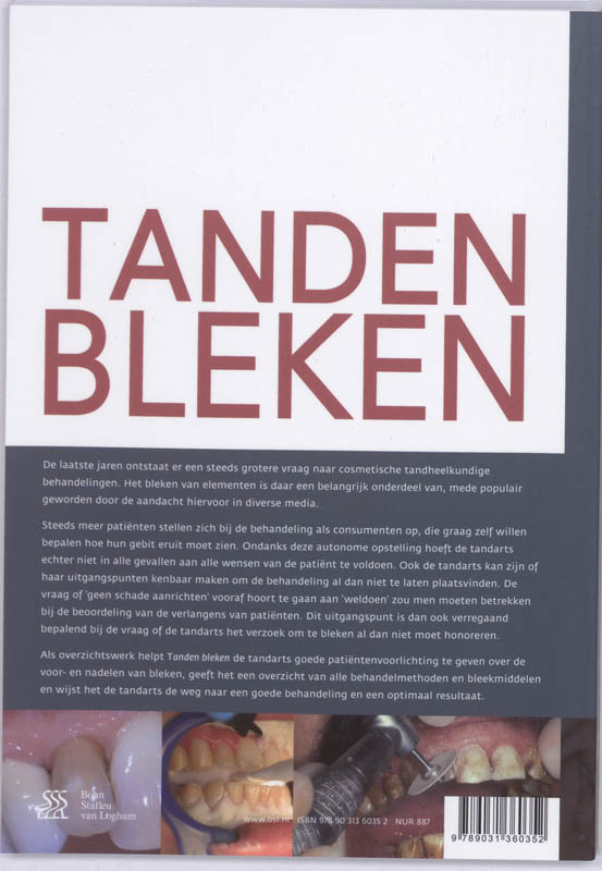 Achterkant van Tanden bleken