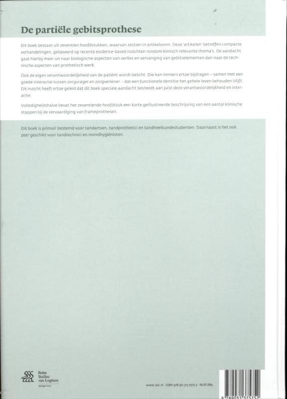Achterkant van De partiele gebitsprothese