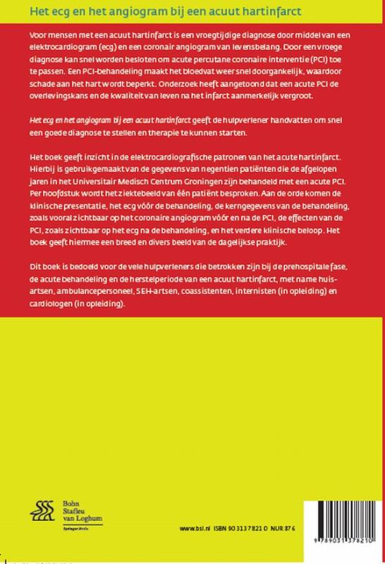 Achterkant van Het ECG en het angiogram bij een acuut hartinfarct