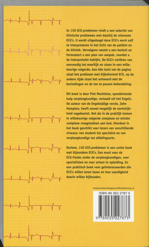 Achterkant van 150 ECG-problemen