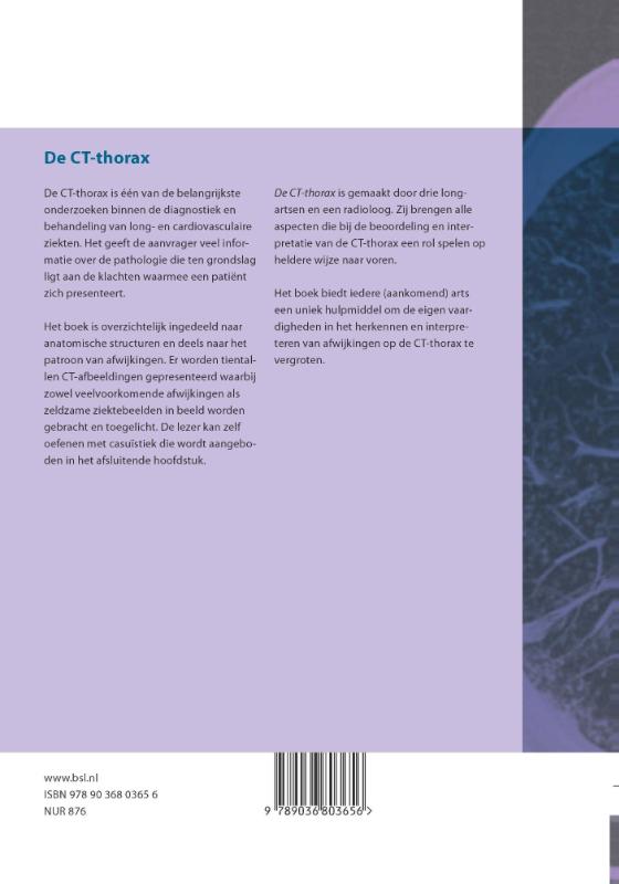 Achterkant van De CT-thorax