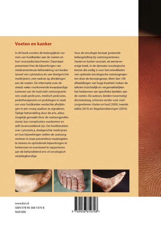 Achterkant van Voeten en kanker