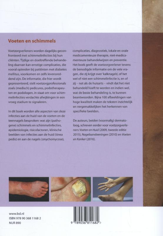 Achterkant van Voeten en schimmels