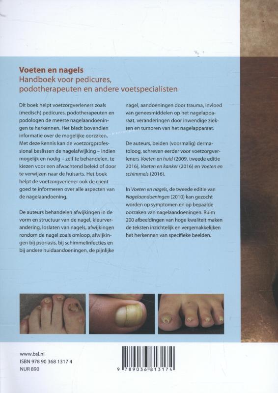 Achterkant van Voeten en nagels