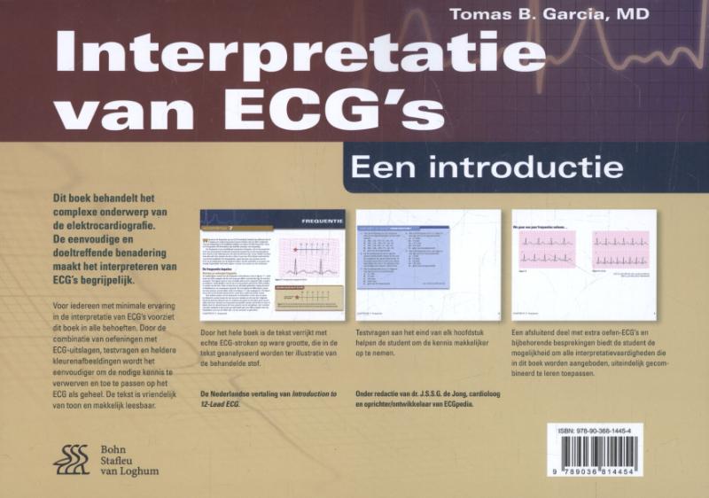 Achterkant van Interpretatie van ECG's