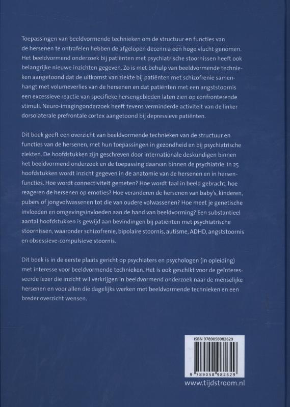 Achterkant van Beeldvorming van het brein