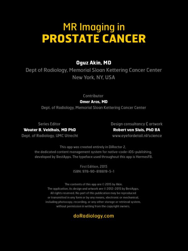 Achterkant van Mr imaging in prostate cancer