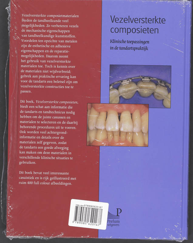 Achterkant van Vezelversterkte composieten
