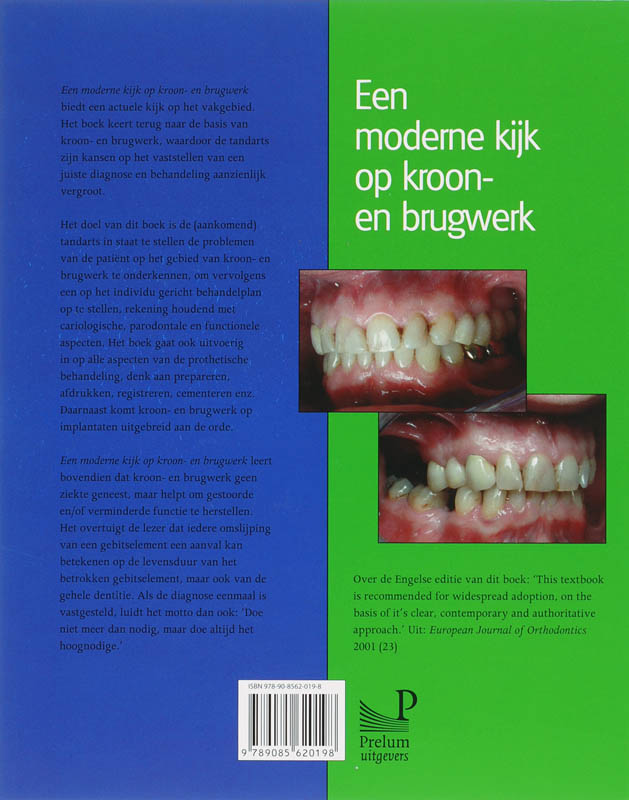 Achterkant van Een moderne kijk op kroon- en brugwerk