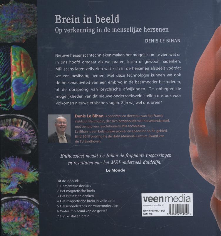 Achterkant van Brein in beeld