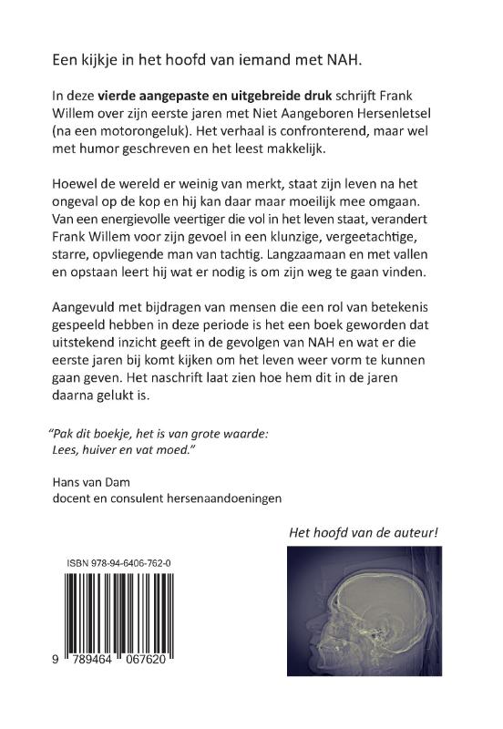 Achterkant van NAHgenoeg niets te zien
