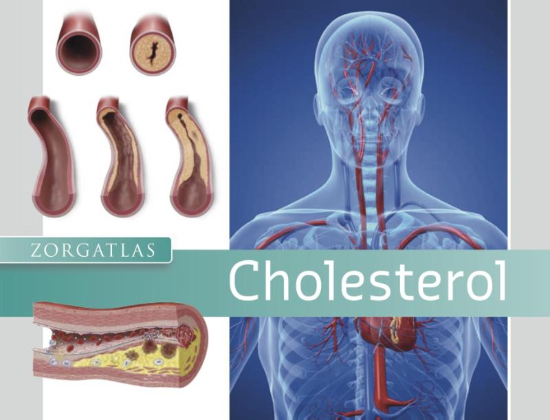Achterkant van Cholesterol