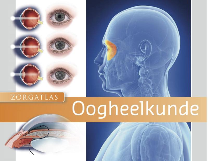 Achterkant van Oogheelkunde