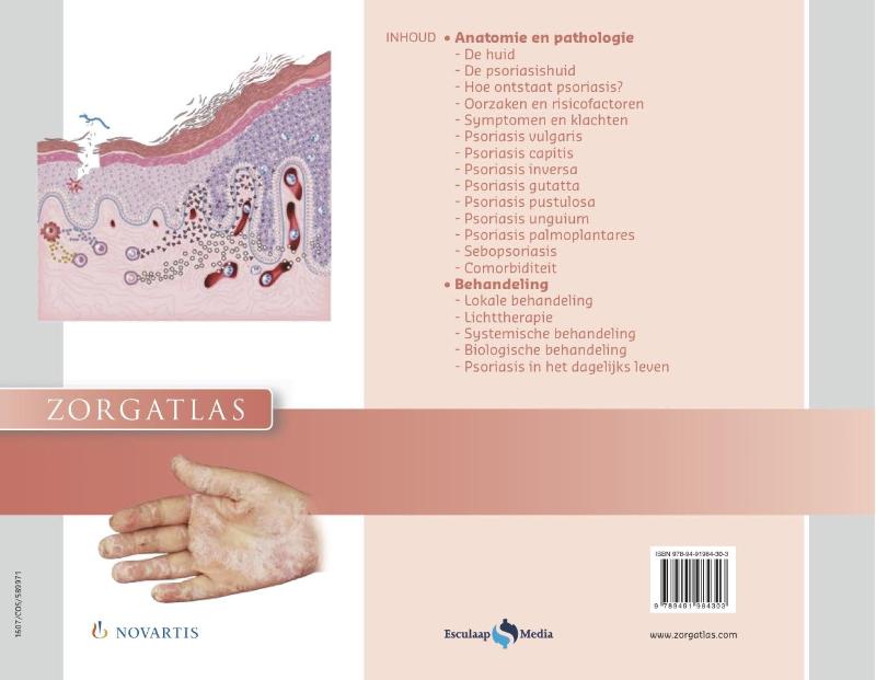 Achterkant van Psoriasis