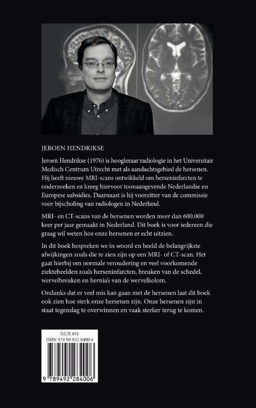 Achterkant van Dit is ons brein