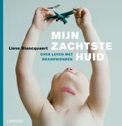 Omslag van Mijn zachtste huid