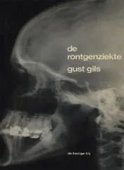 Omslag van De röntgenziekte