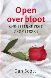 Omslag van Open over bloot