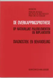 Omslag van De overkappingsprothese op natuurlijke pijlerelementen en implantaten