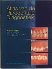 Omslag van Atlas van de parodontale diagnostiek