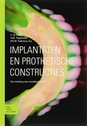 Omslag van Implantaten en prothetische constructies
