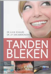 Omslag van Tanden bleken