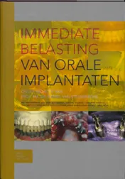 Omslag van Immediate belasting van orale implantaten
