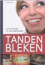 Omslag van Tanden bleken