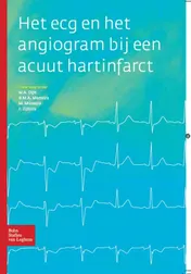 Omslag van Het ECG en het angiogram bij een acuut hartinfarct
