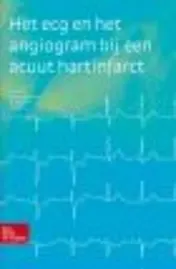 Omslag van Het ECG en het angiogram bij een acuut hartinfarct