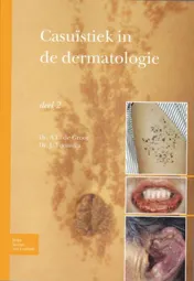 Omslag van Casuïstiek in de dermatologie