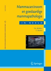 Omslag van Mammacarcinoom en goedaardige mammapathologie in beeld