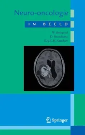 Omslag van Neuro-oncologie in beeld