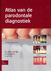 Omslag van Atlas van de parodontale diagnostiek