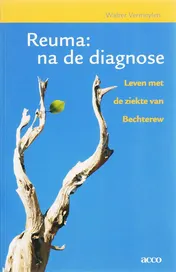 Omslag van Reuma: na de diagnose