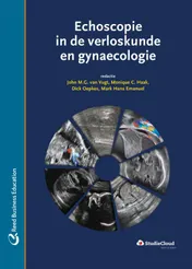 Omslag van Echoscopie in de verloskunde en gynaecologie