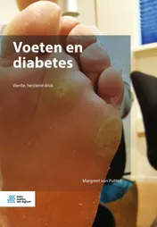 Omslag van Voeten en diabetes